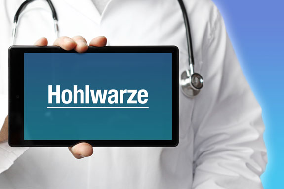 Schlupfwarzen Erding